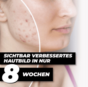 MAXSKIN SKINCARE® Gesichtscreme, Bild 2